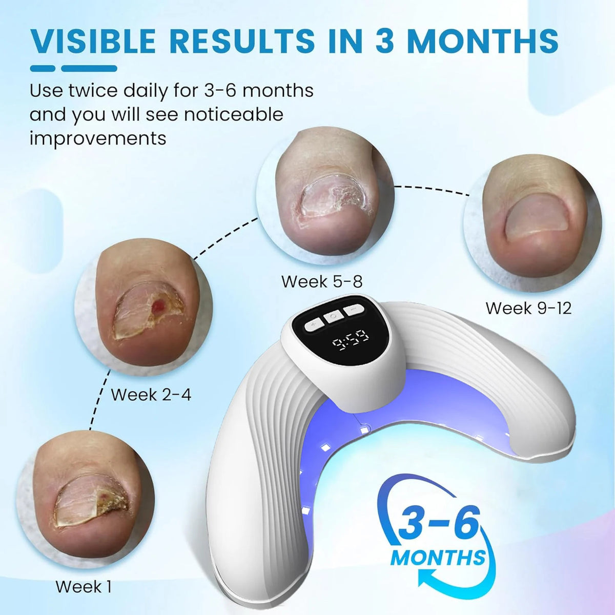 LED Nail Fungus Treatment Lamp with Infrared & Blue Light for Nail Care