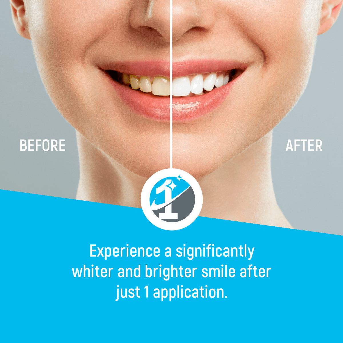 20-Pack Tooth Polishing Paste and Stain Remover with Grit Options - Mint