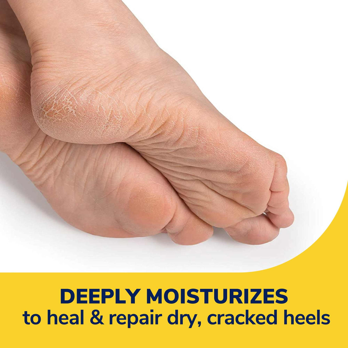 Heel Repair Balm with Urea for Cracked Heels - 2.5 oz