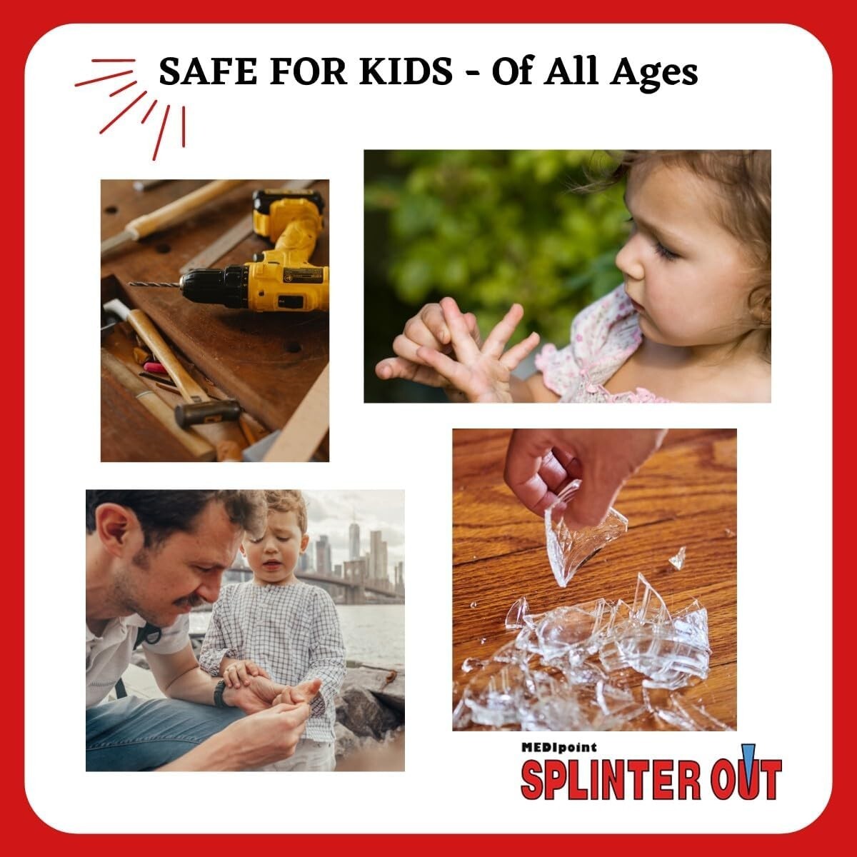 Splinter Out Remover Kit - 20 Sterile Medical Tools for Splinter Removal
