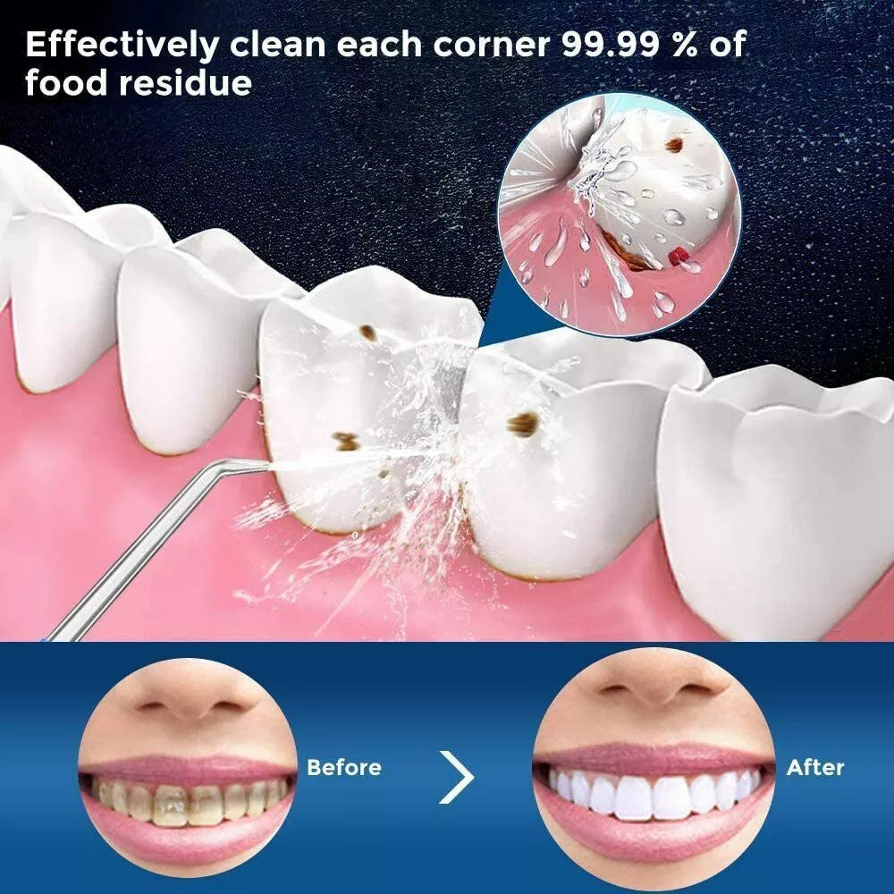 Cordless Water Flosser Dental Oral Irrigator with 5 Tips for Deep Cleaning & Gum Care