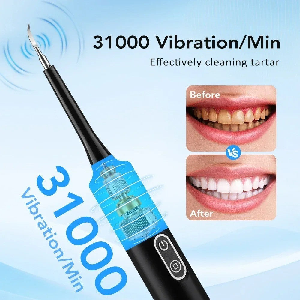 Electric Dental Scaler with 5 Modes, LED Light & USB Rechargeable