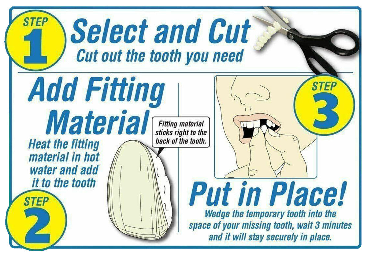 Temporary Tooth Repair Kit - Multi Shade Cosmetic Dental Fix