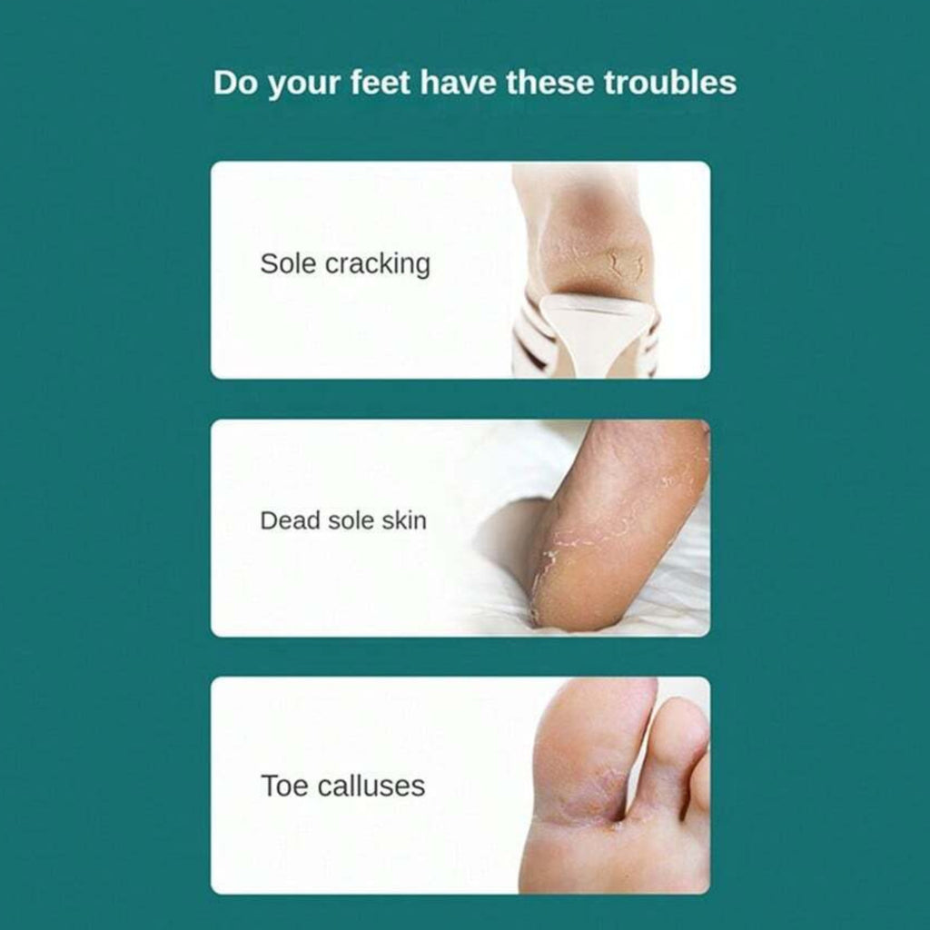 2-Pack Foot Heel Scraper Callus Remover for Pedicure & Foot Care