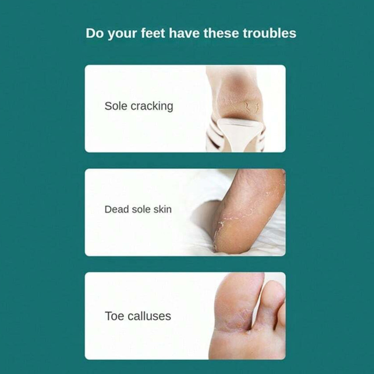 2-Pack Foot Heel Scraper Callus Remover for Pedicure & Foot Care