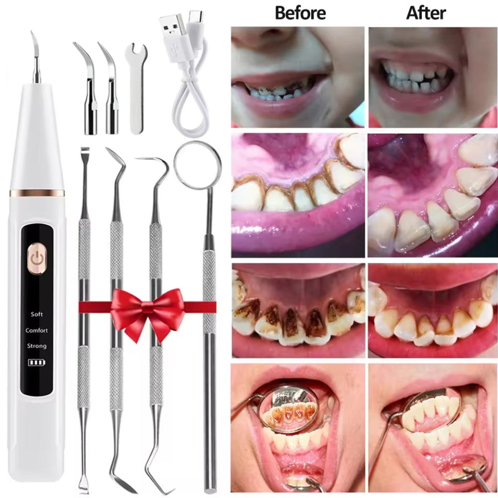 Ultrasonic Tooth Cleaner Tartar Remover with LED Light for Dental Hygiene