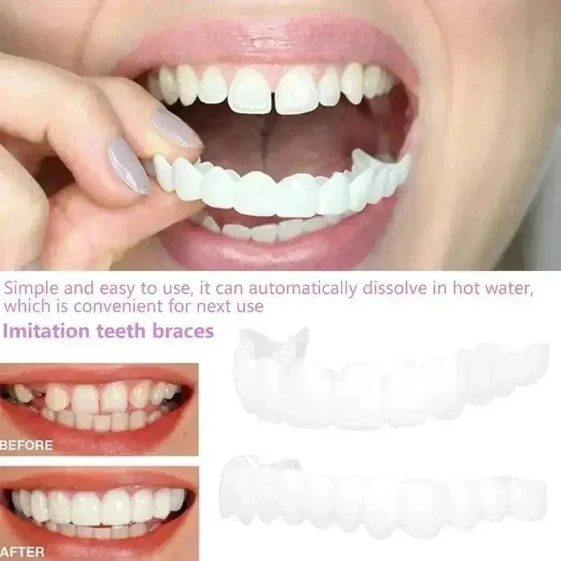 Snap-On Veneers Teeth Kit for Women and Men - Instant Bright Smile