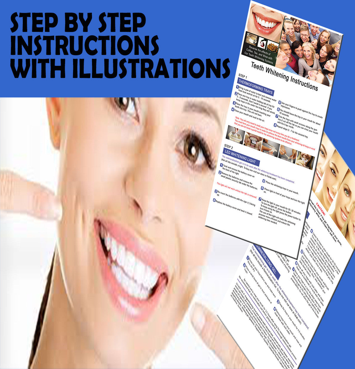 Kit with Gel Syringes & Mouth Trays - Fast Results