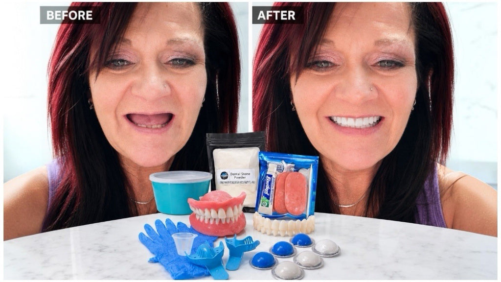 DIY Denture Kit Complete Set for Custom Temporary Teeth - Full or Partial