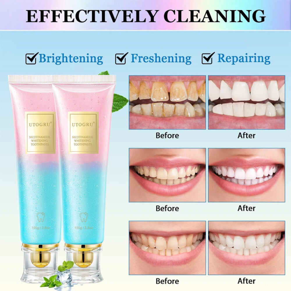 Nicotinamide Whitening Toothpaste 100g - Fresh Breath & Surface Stain Removal