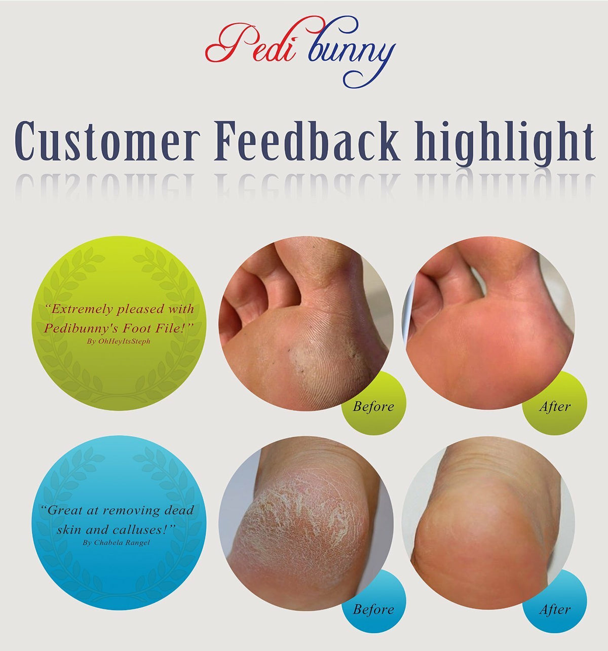 Rechargeable Electric Callus Remover Foot File for Men Women - Pedicure Spa Tool