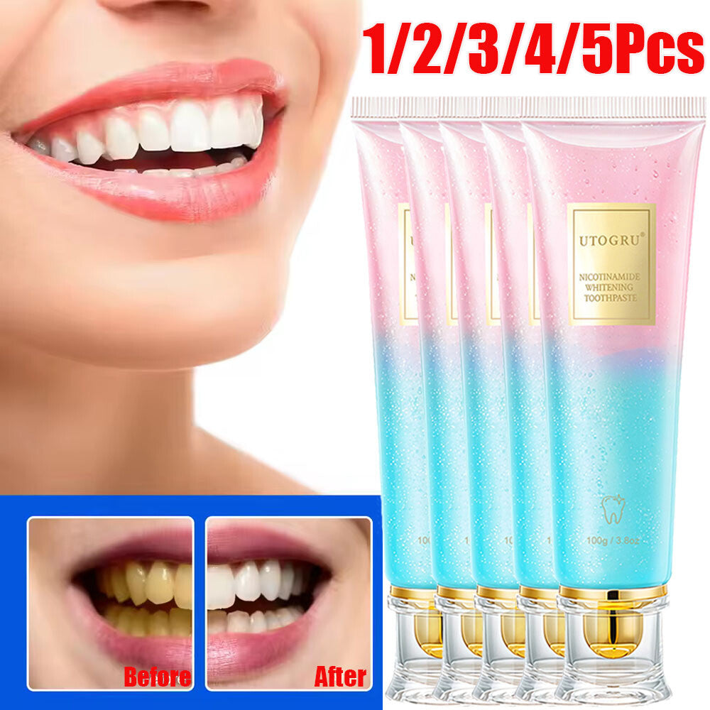 Nicotinamide Whitening Toothpaste for Brightening & Fresh Breath - 100g