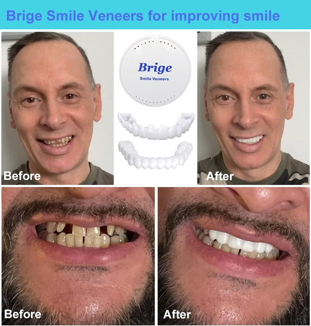 Temporary Denture Set - Custom Fit Reusable False Teeth for Smile Enhancement