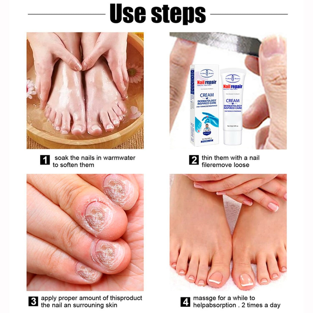 Nail Repair Cream for Damaged Nails - Hydrates & Restores 20g