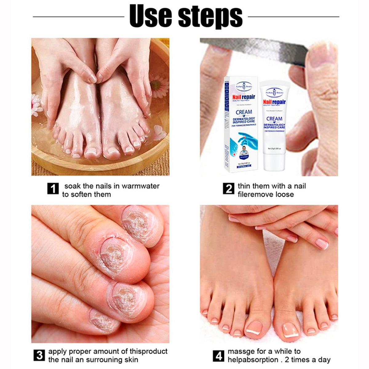 Nail Repair Cream for Damaged Nails - Hydrates & Restores 20g