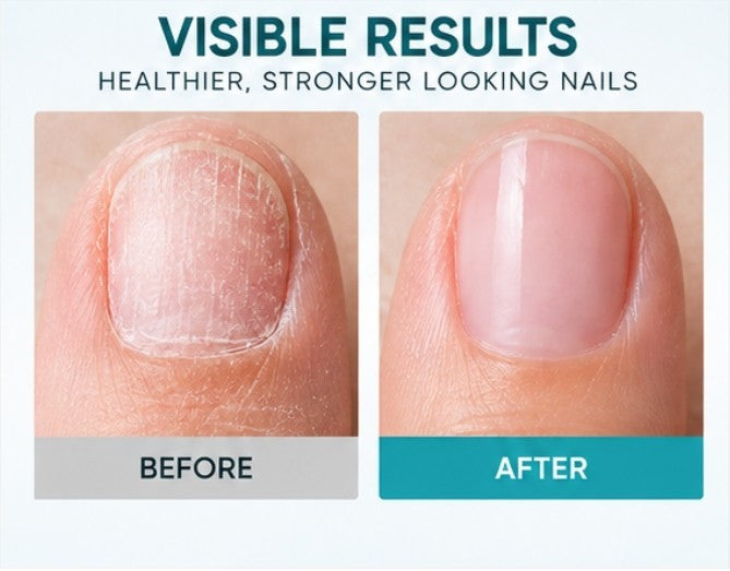 Nail Care Keratin Treatment for Damaged Nails - 0.5oz / 15ml