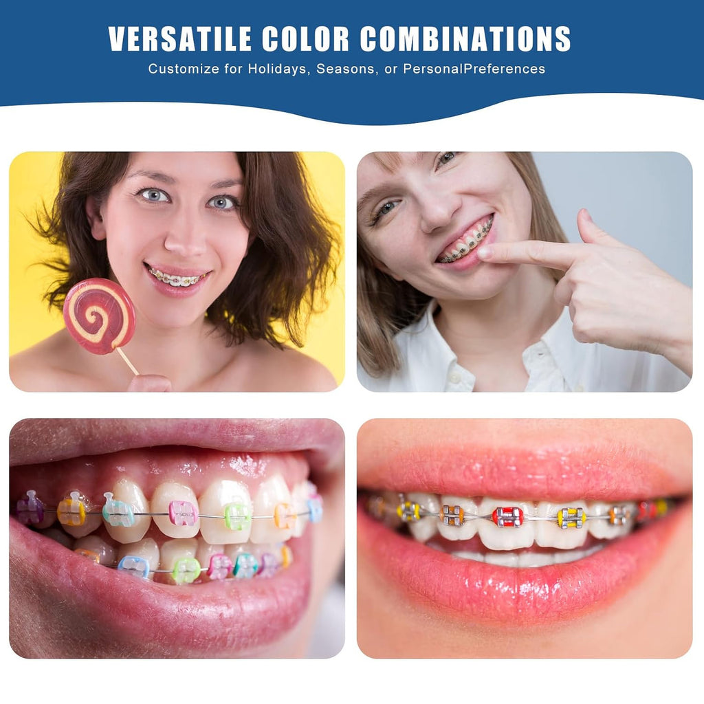Multi-Color Orthodontic Ligature Set for Braces - 2080 Rubber Bands DIY