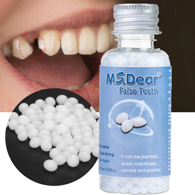 Temporary Moldable Dental Repair Beads for Broken Teeth - 30ml