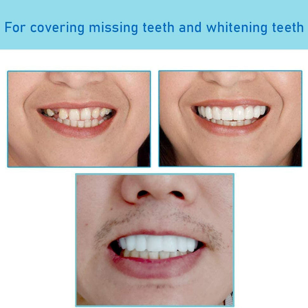 Snap-On Upper and Lower Dental Veneers Set - Reusable Teeth Cover for Adults