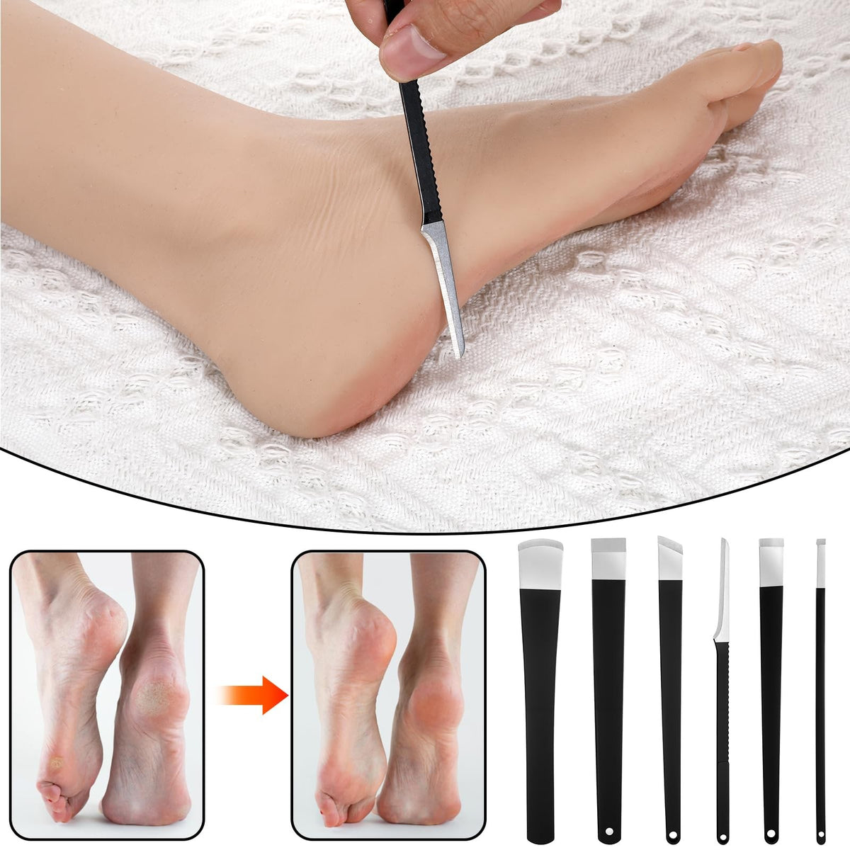 Ingrown Toenail Removal Kit with Pedicure Tools & Storage Box - Foot Care Set