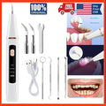 Electric Ultrasonic Dental Teeth Cleaner Tartar Removal with LED Light