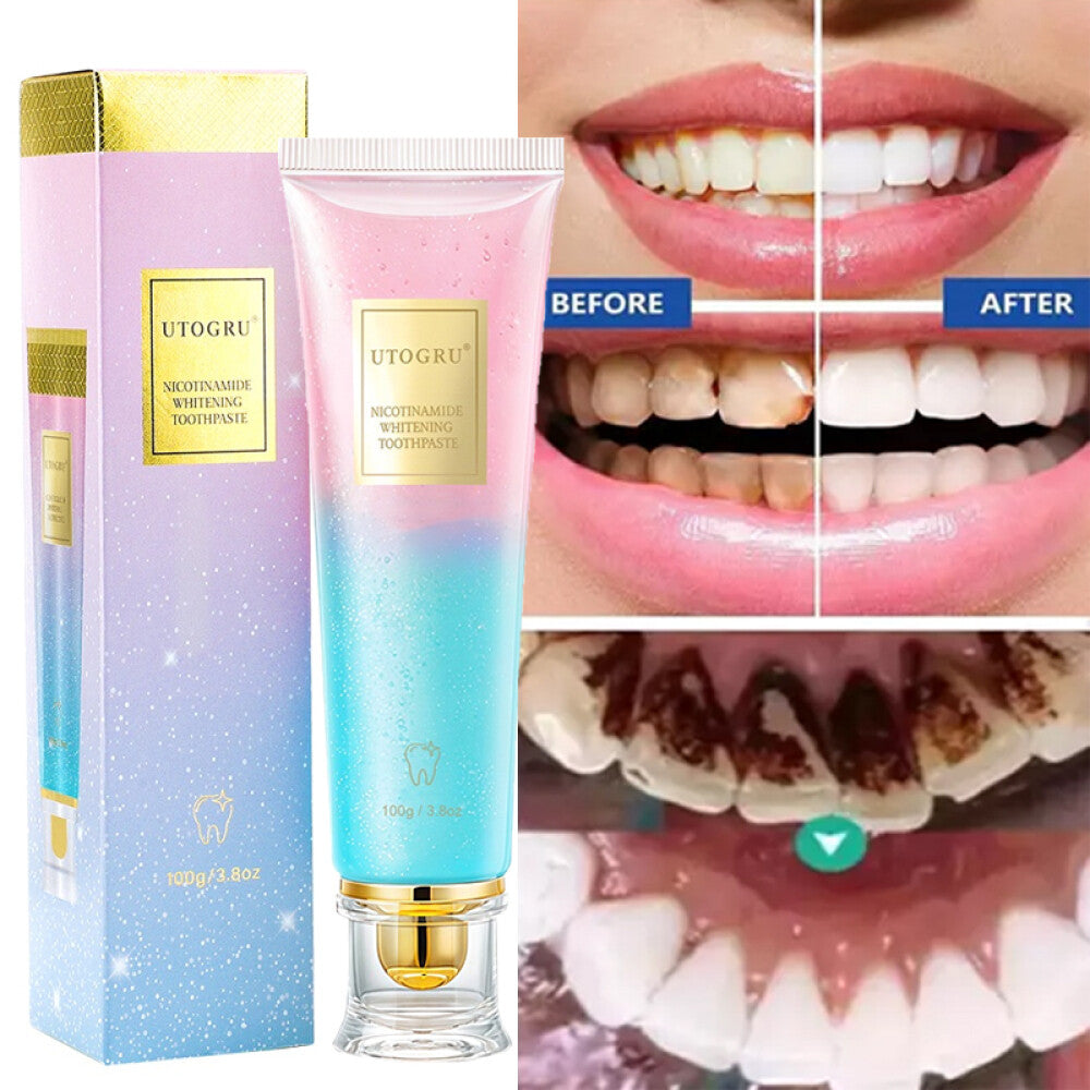 Nicotinamide Whitening Toothpaste 100g - Fresh Breath & Surface Stain Removal