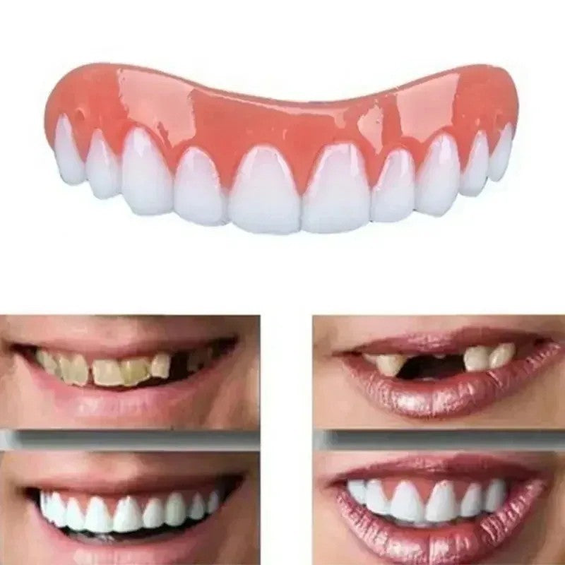 Upper and Lower Snap-On Dental Veneers Set - False Teeth Cover