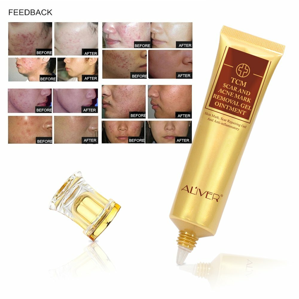Scar and Acne Mark Removal Gel for Skin Blemish Healing – Multiple Packs