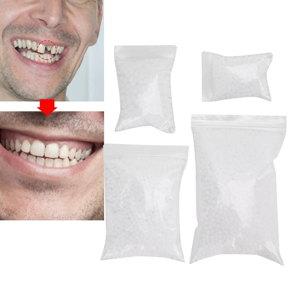 Temporary Tooth Repair Beads Granules - Moldable Dental Pellets for False Teeth