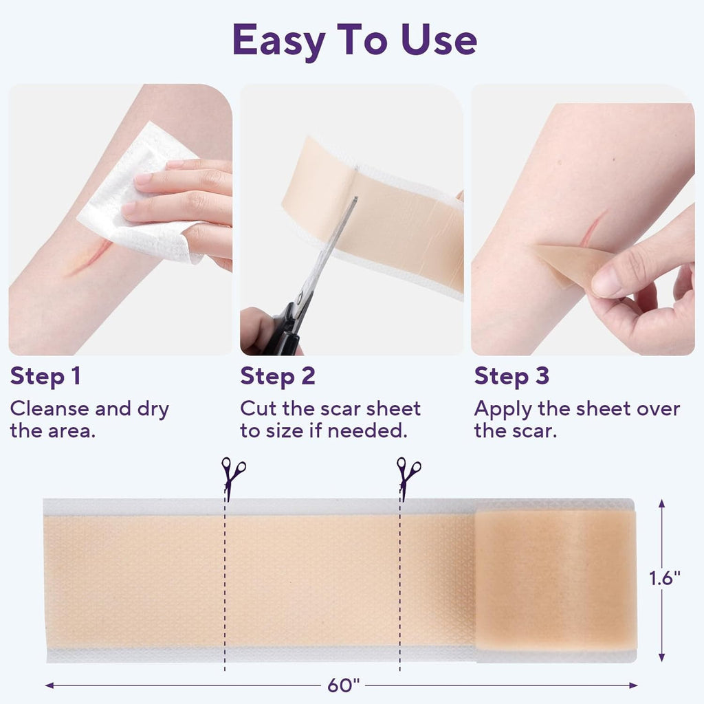 Silicone Scar Removal Tape for Hypertrophic Scars & Keloids - 1.6" x 60" Reusable Strip
