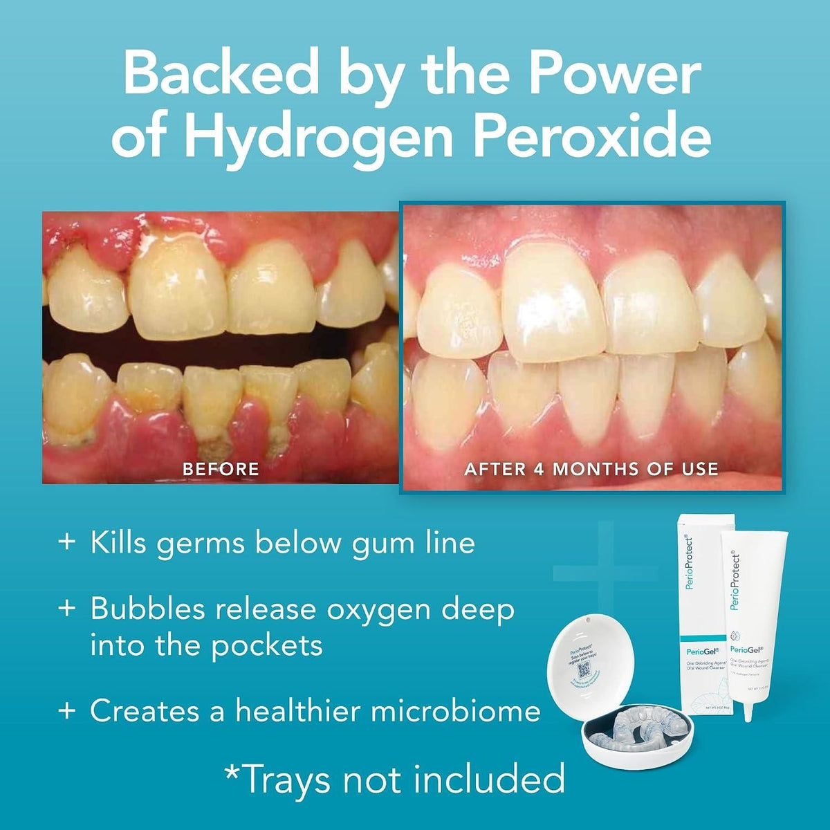 Periodontal Gel for Teeth & Gum Care - 3 Oz Oral Hygiene Support
