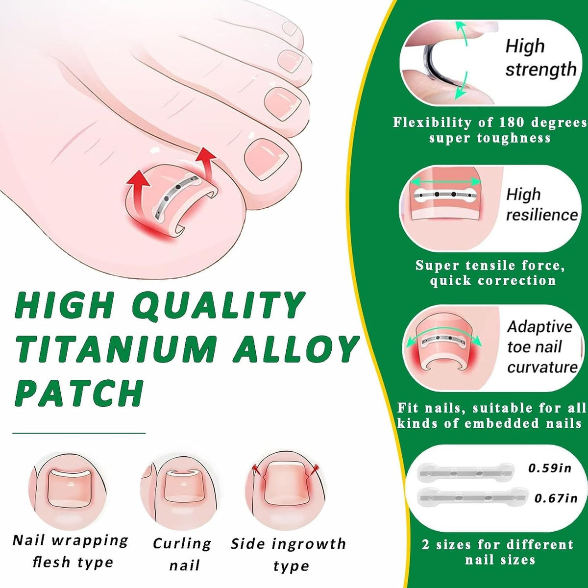 Ingrown Toenail Correction Patch Kit - Nail Fix & Deformation Treatment