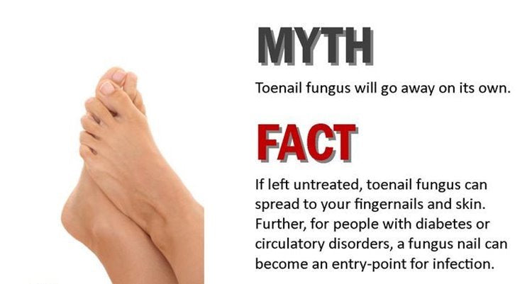 Natural Nail Fungus Treatment for Toe & Finger Nails - Heal & Restore