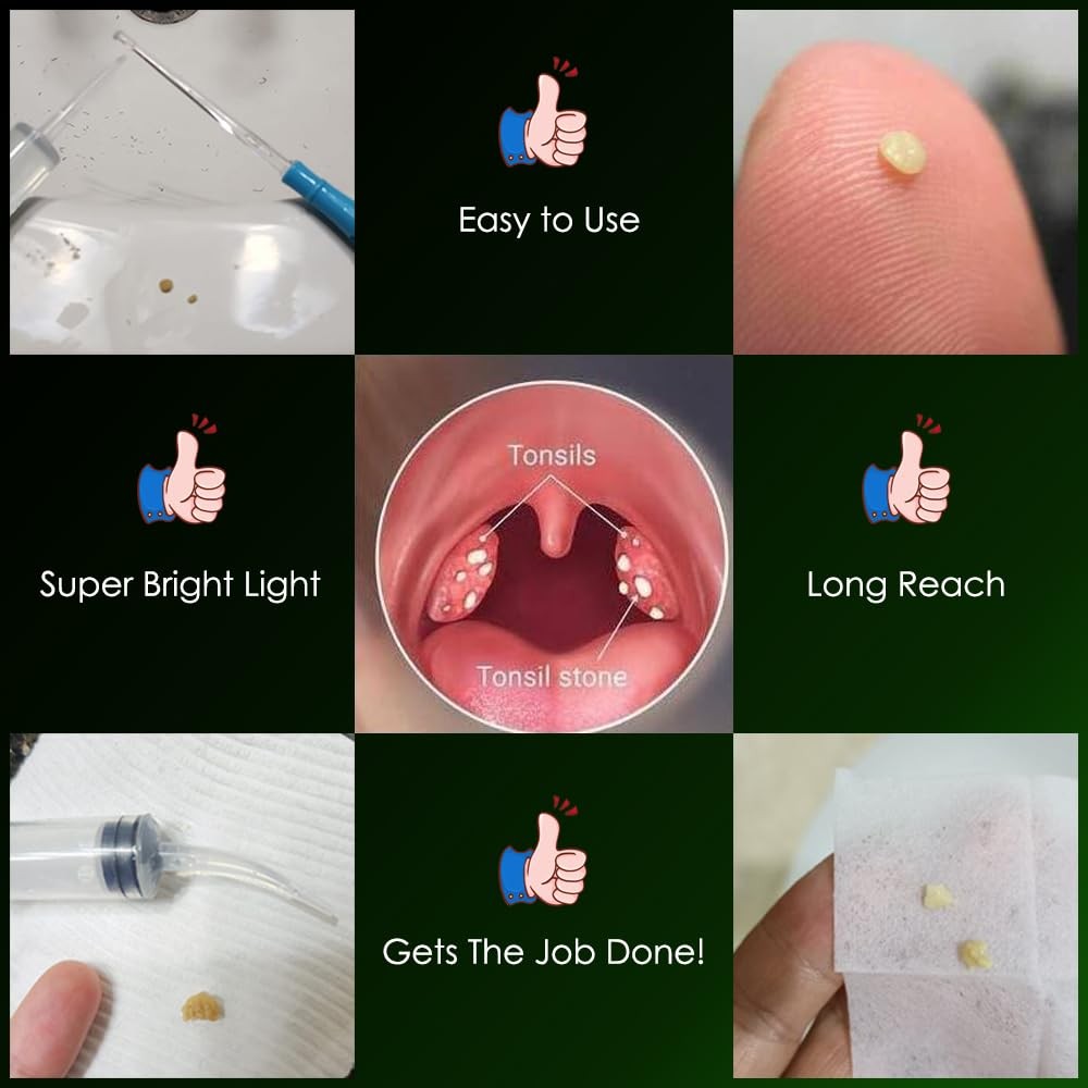 Tonsil Stone Remover Kit with Lighted Tips - Oral Irrigator for Bad Breath