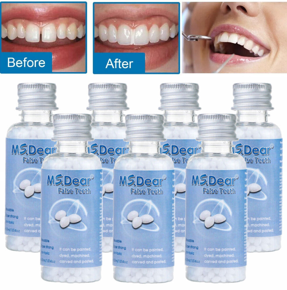 Teeth Thermal Fitting Beads Set for Temporary Tooth Repair & DIY Moldable Veneers