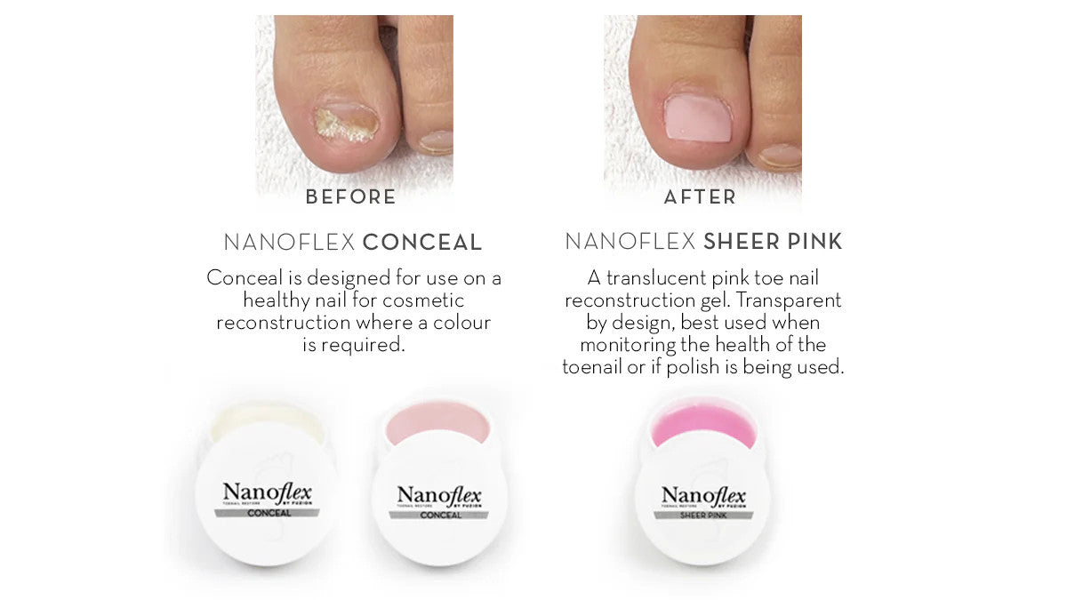 Fuzion UV/LED Nanoflex Toenail Concealer 12g - Natural Fungal Nail Treatment