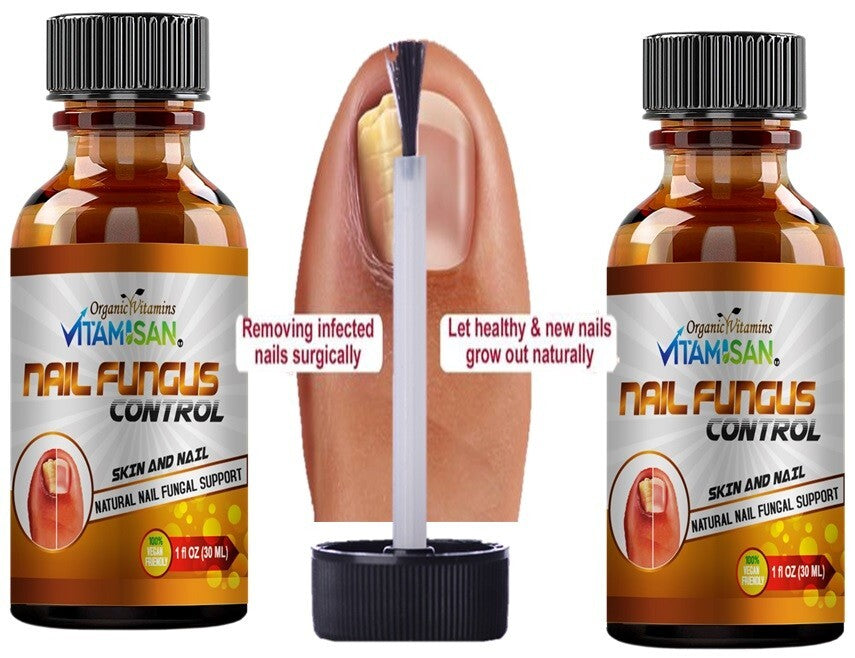 Maximum Strength Antifungal Toenail & Foot Support Spray for Athlete's Foot