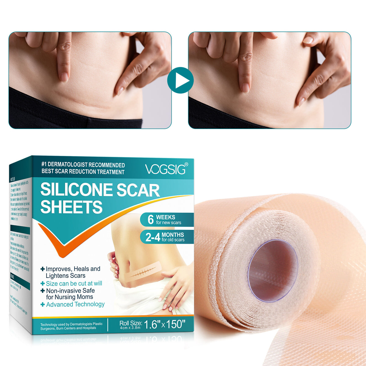 Silicone Scar Removal Sheets Gel Patches Skin Repair Wound Burn Healing