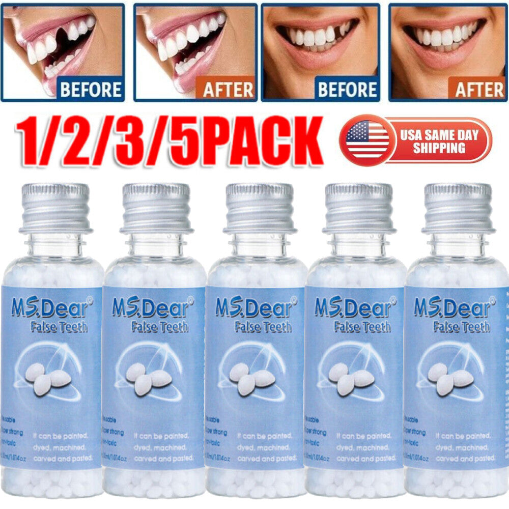 Teeth Thermal Fitting Beads Set for Temporary Tooth Repair & DIY Moldable Veneers