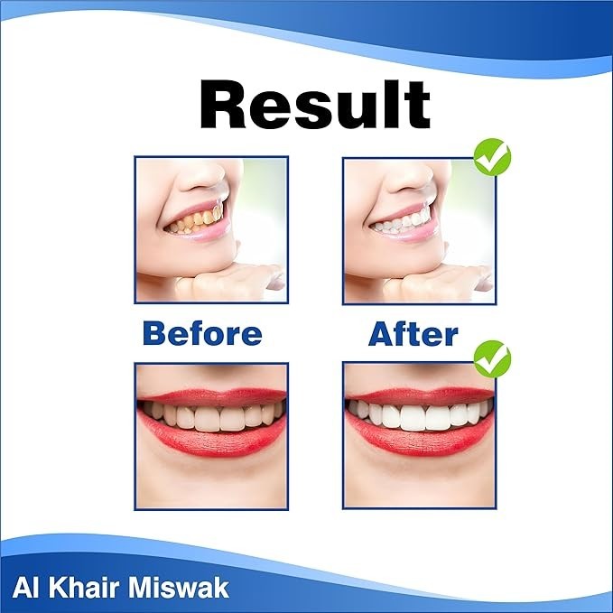 Natural Miswak Toothbrush Sticks - Eco-Friendly Oral Care Bulk Pack