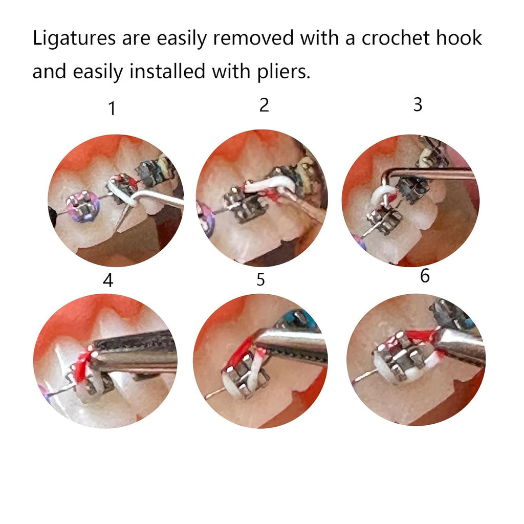 Multicolor Orthodontic Ligature Ties Kit Rubber Bands for Braces DIY Replacement