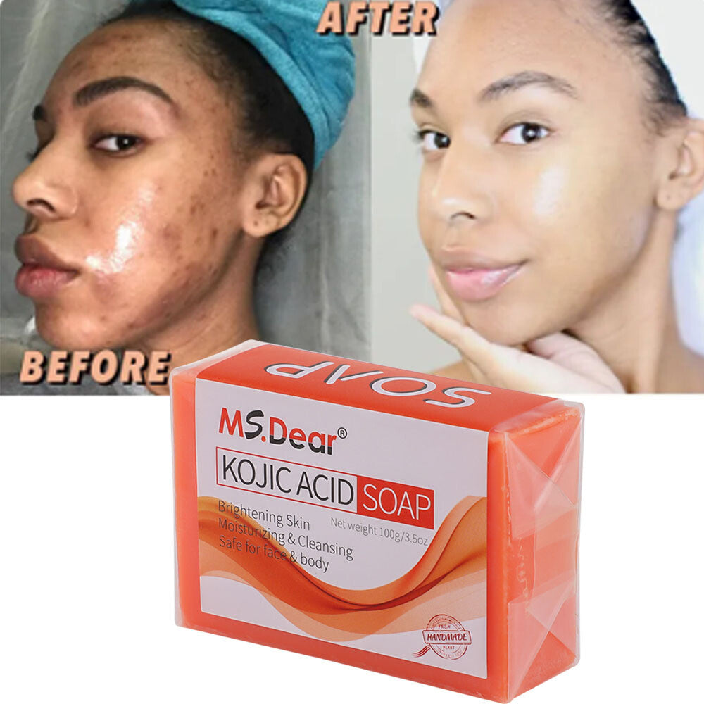Kojic Acid Soap for Dark Spot Removal & Skin Lightening - Face & Body