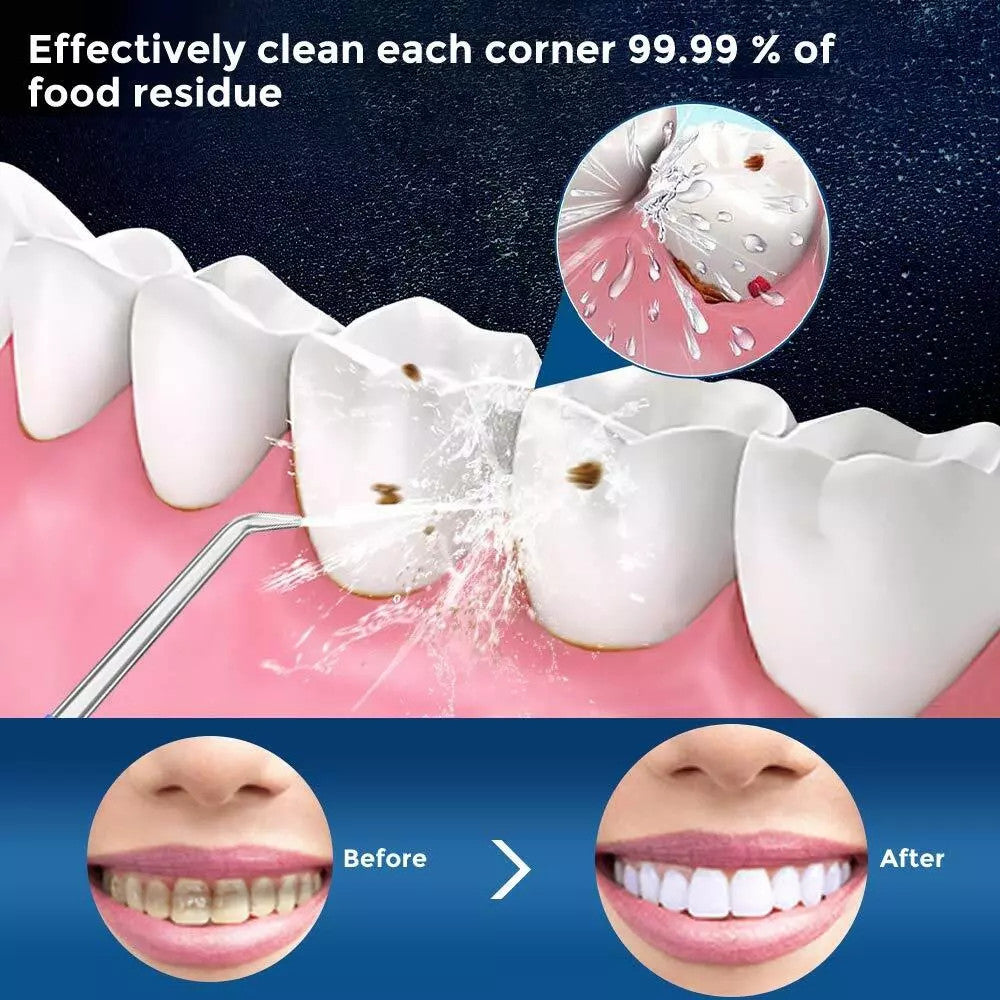Cordless Water Flosser Dental Oral Irrigator - Rechargeable, 6 Tips, IPX7 Waterproof