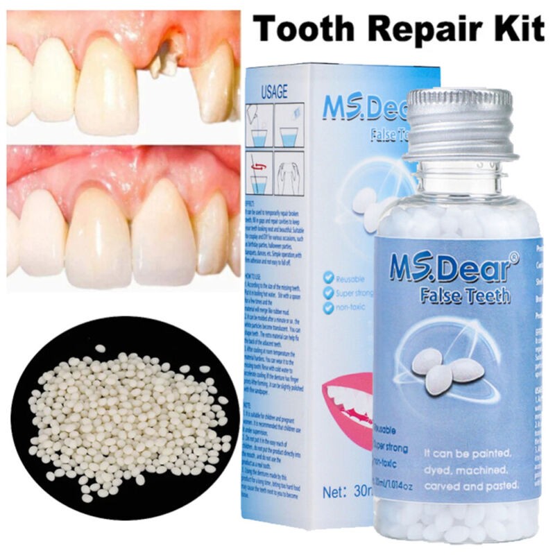 Moldable Teeth Repair Glue for Gaps & Broken Teeth - 30ml