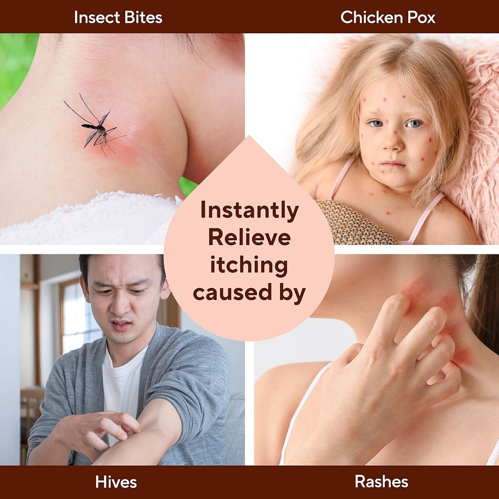 Itch Relief Bar Soap for Skin Irritations and Insect Bites - Natural Healing