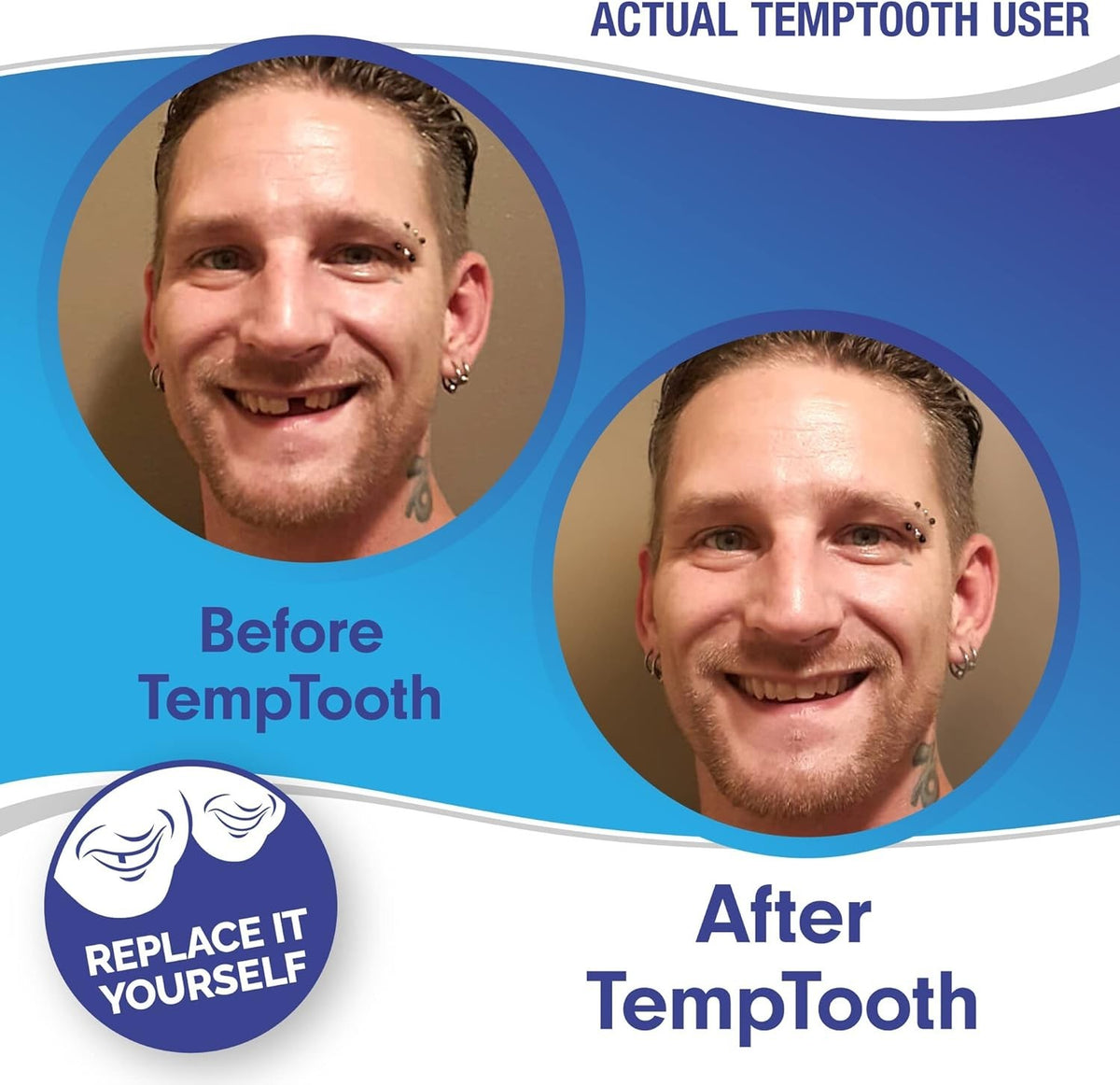 Temporary Tooth Replacement Kit - DIY Natural Smile Repair