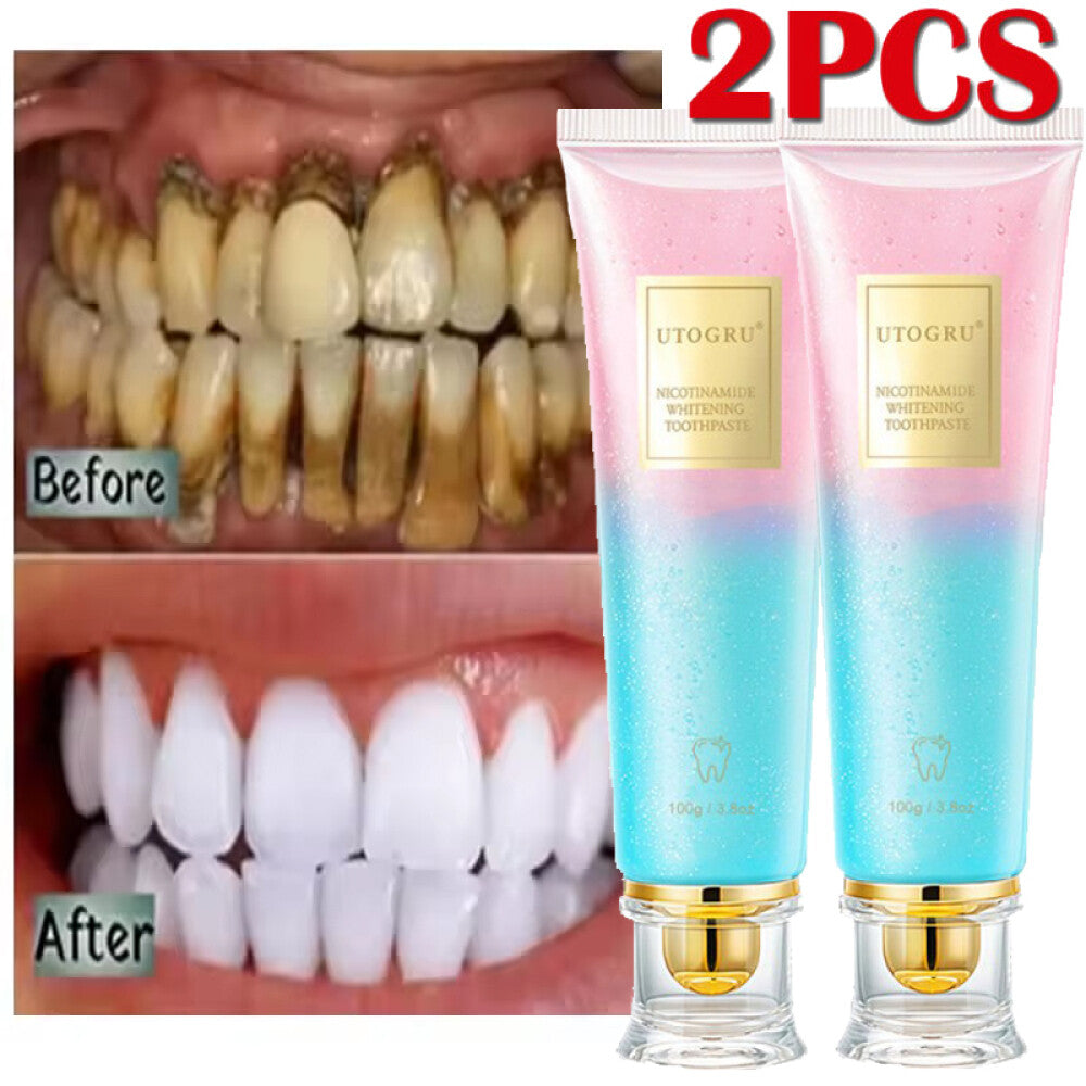 Nicotinamide Whitening Toothpaste for Brightening & Fresh Breath - 2X Pack 100g