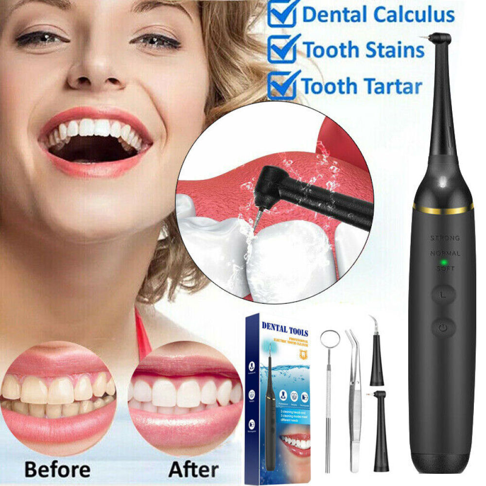 Ultrasonic Tooth Cleaner Plaque & Tartar Remover - Rechargeable Dental Scanner
