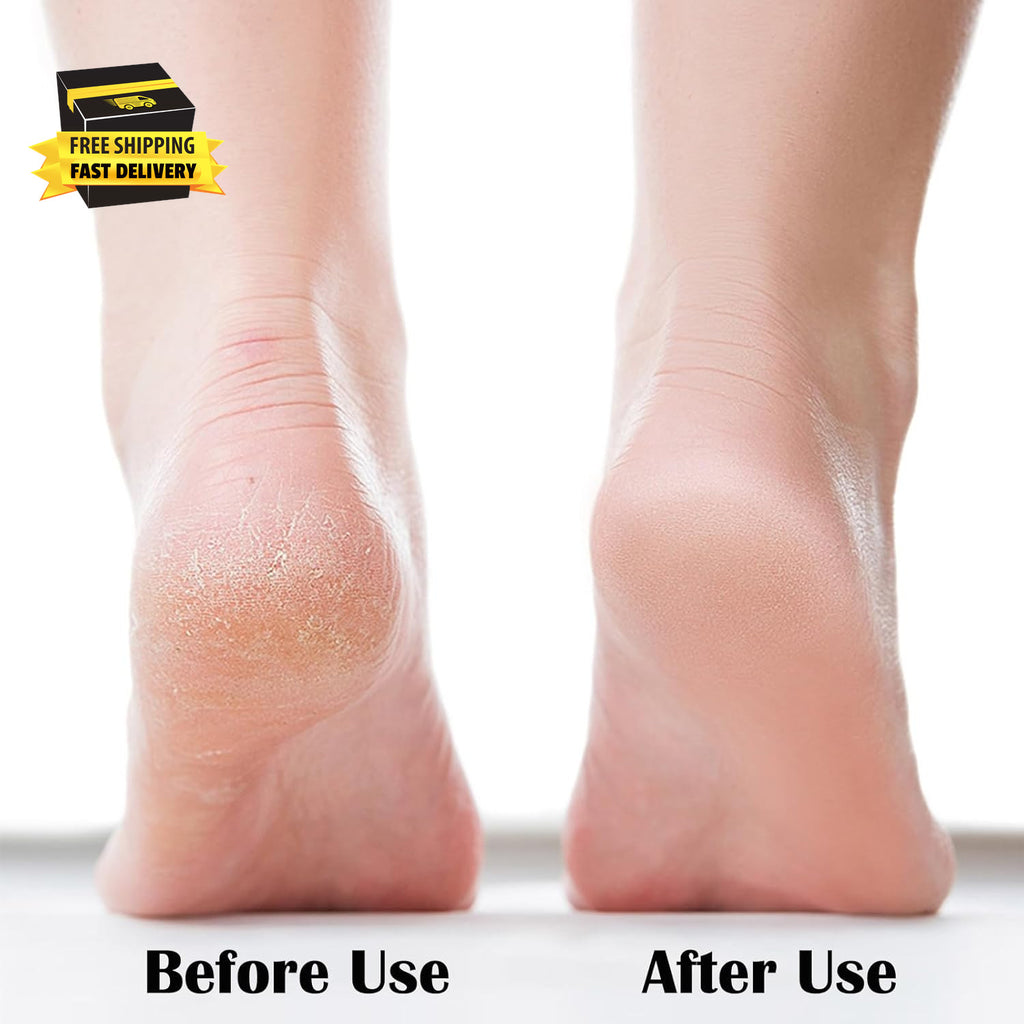 Nano Glass Foot File Callus Remover Pedicure Tool for Dead Skin Removal