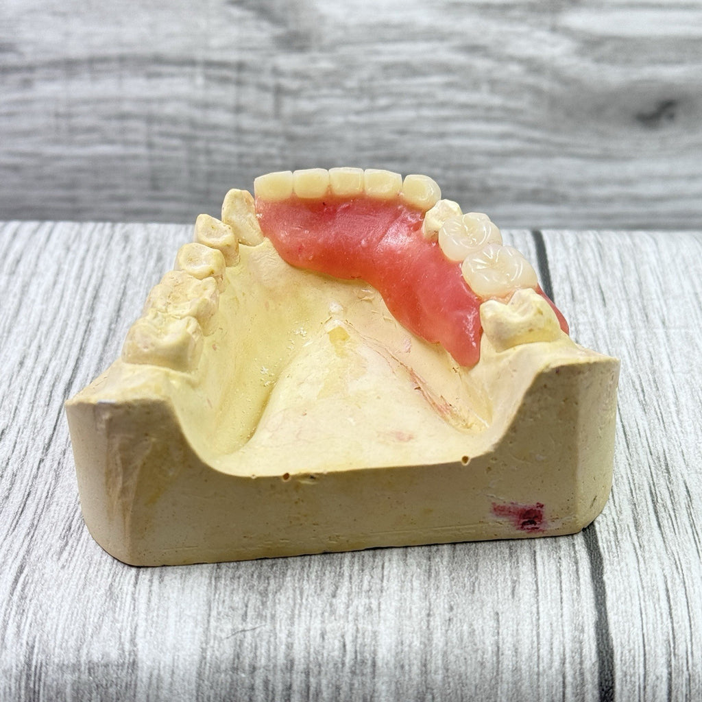Partial Denture Kit - Make Custom Temporary Teeth A2, Reusable & Easy